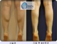 MICP Ⱓ  Ƹ  Ұ