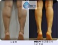 MICP+Ŭ  1     