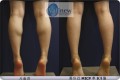 MICP   ε巯 Ƹ Ƿ翧
